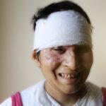Nisha, an acid attack survivor and client of Make Love Not Scars