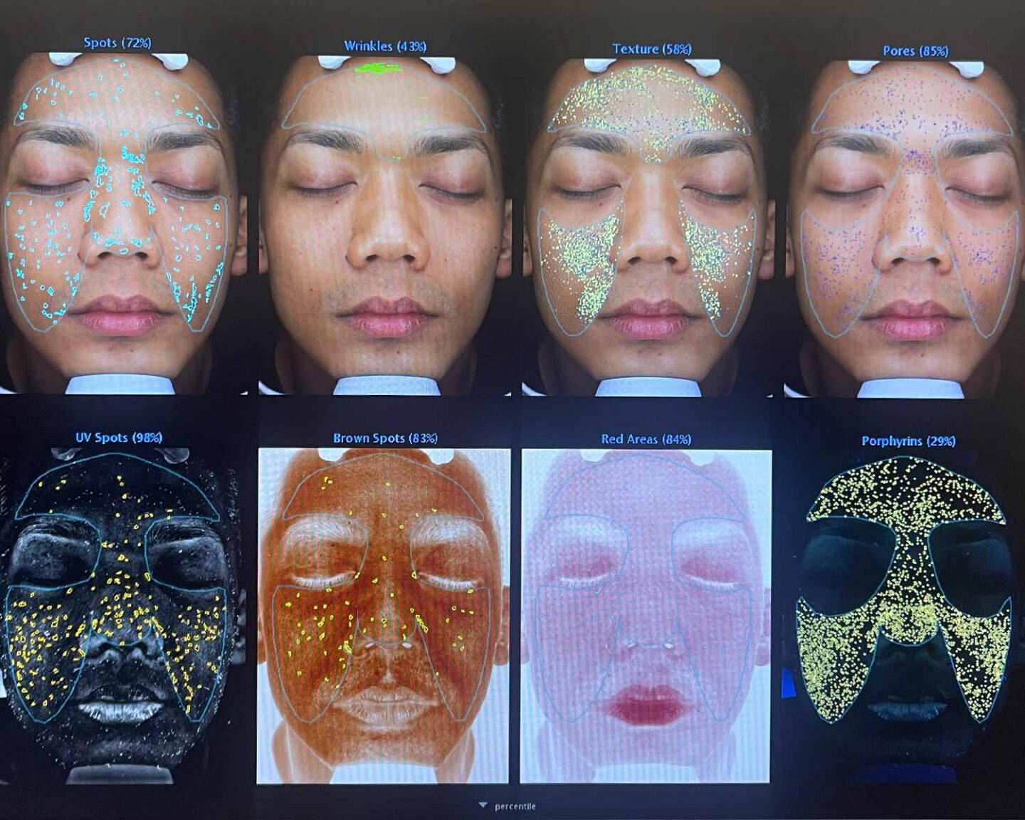 A very revealing look at my skin beyond the superficial layer